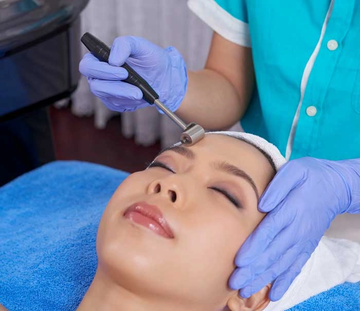 needling